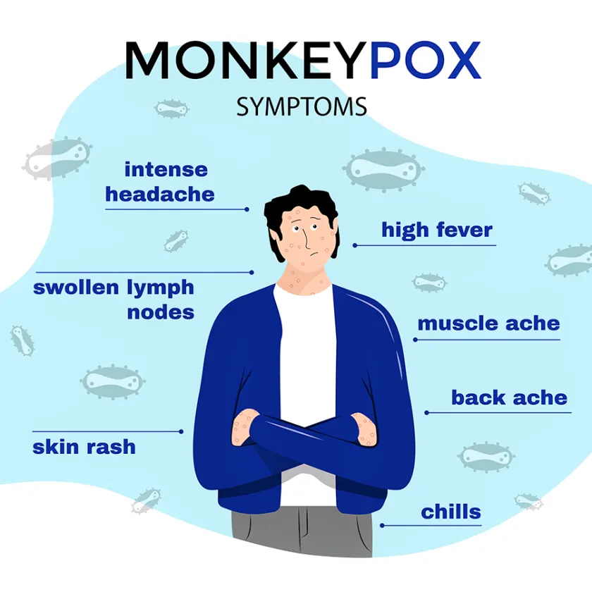 monkeypox symptoms