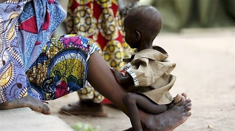 UN says 1.4 million children at imminent risk of death in famines