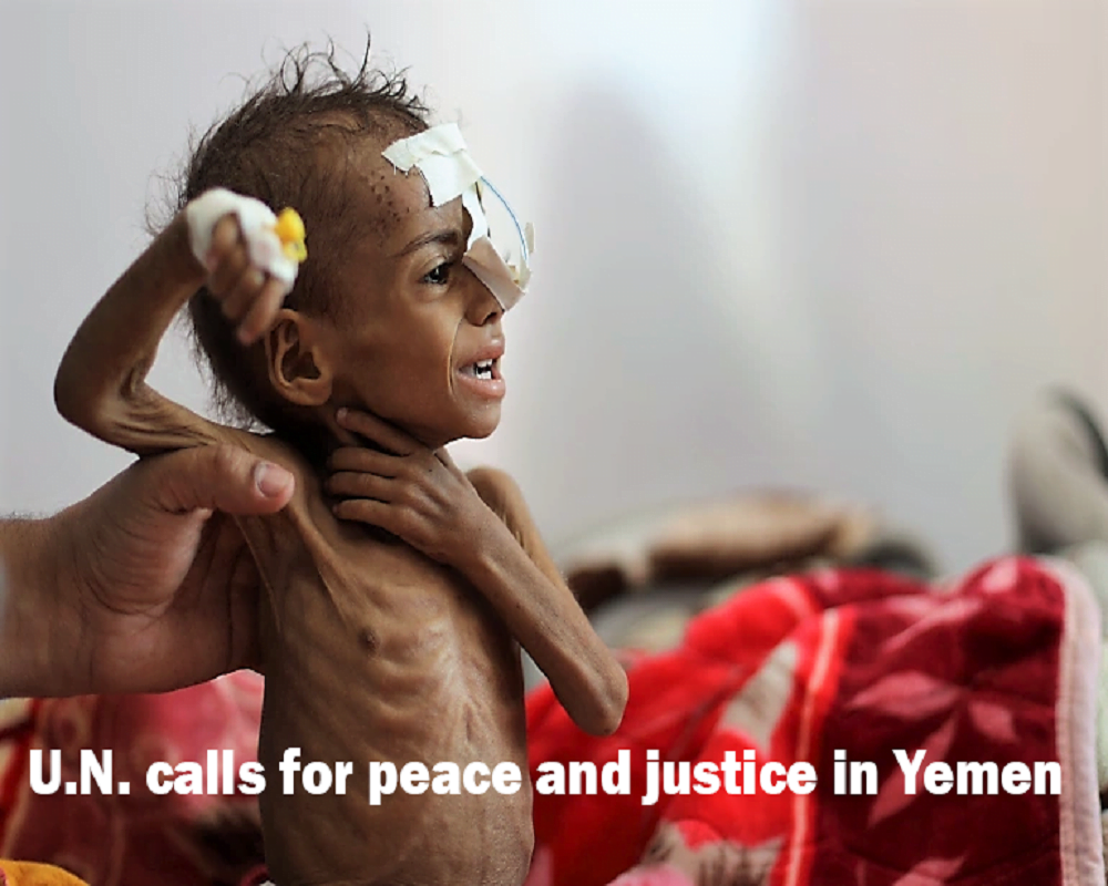 U.N. calls for peace and justice in Yemen